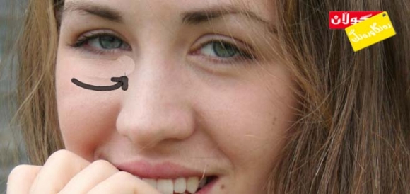 ئاوسانی بەری چاوەكان