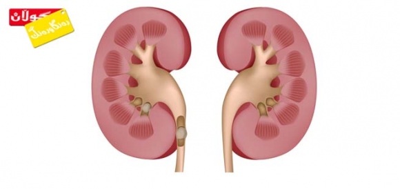 ئایا كیسی گورچیلە مەترسی هەیە؟