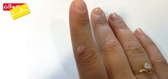 بالووكە دەگوازرێتەوە