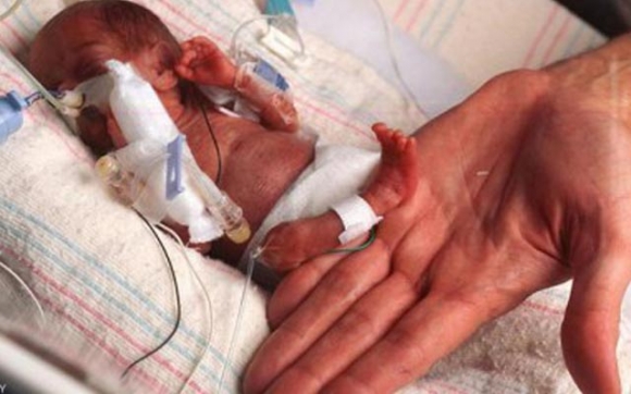 منداڵێک لەدایکدەبێت کێشی 560 گرامە