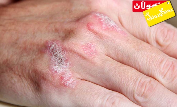 چی لەبارەی سەدەفەوە دەزانیت؟