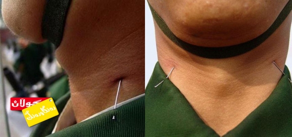 سەربەرزكردن بە دەرزی و دەمبووز !