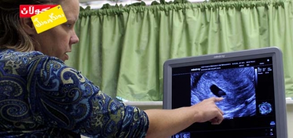 ئیكۆی دڵ چیمان نیشان دەدات؟