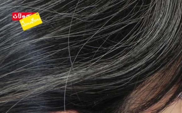 هۆكارەكانی قژ سپیبوون