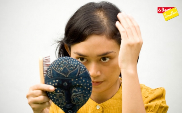 كام دەرمان دەبێتە هۆی قژهەڵوەرین