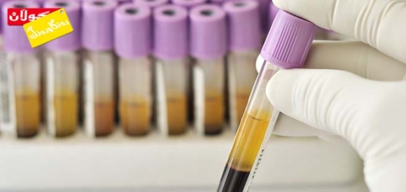 كام پشكنین پێویستە بۆ دڵنیابوون لە كۆنترۆلكردنی نەخۆشیی شەكرە؟