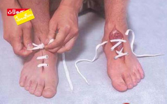 پێڵاوێك لە پێستی مرۆڤ!!