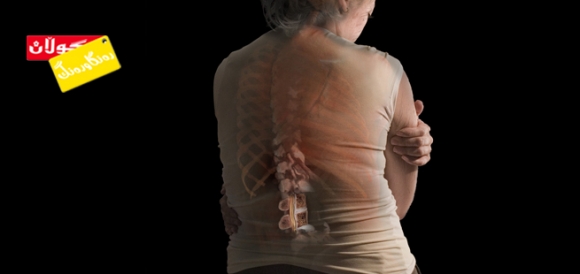 لاوازبوونی ئێسك .. پەتایەكی شاراوە