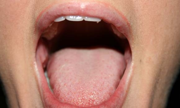 هۆكارەكانی كەمبوونەوەی لیك