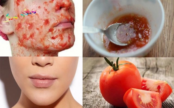 سودەکانی ماسکی تەماتە و شێوازی بەکارهێنانی