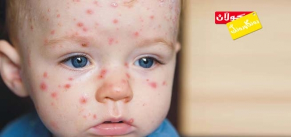 مێكوتە مەترسیدار نییە