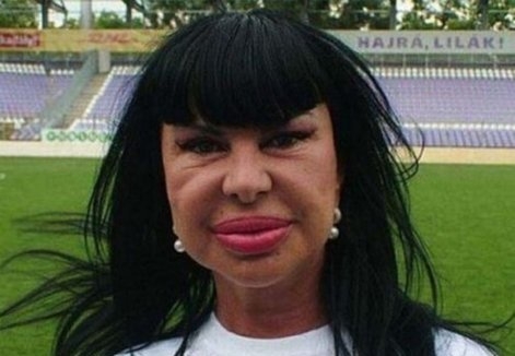 خراپترین نه‌شته‌رگه‌ری جوانكاری له‌ مێژوودا