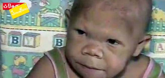 منداڵێكی بچووك كچێكی (30) ساڵانەیە