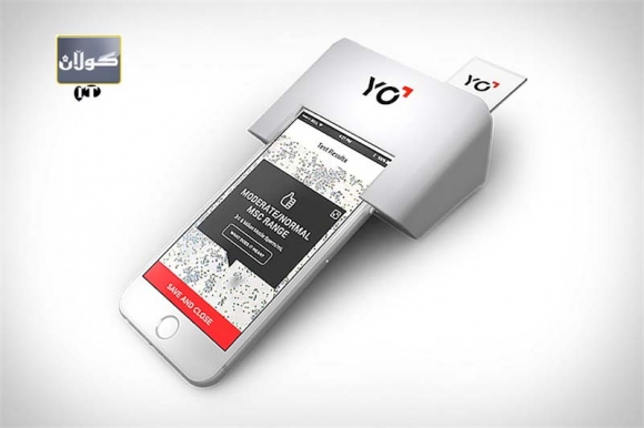 مۆبایل دەبێتە تاقیگەی گرفتی نەزۆكی