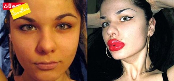 مۆدەی لێو گەورە كردن