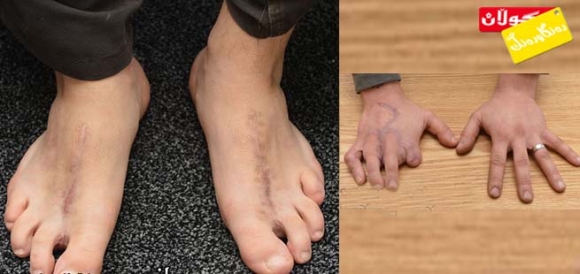 پەنجەی قاچ بۆ پەنجەی دەست!