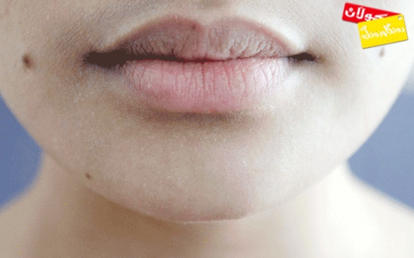 وشكبوونی پێســــــــــــــــــــتی دەوری دەم