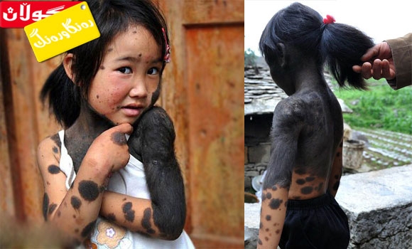 جەستەیەكی ڕەش و سپی منداڵێك!