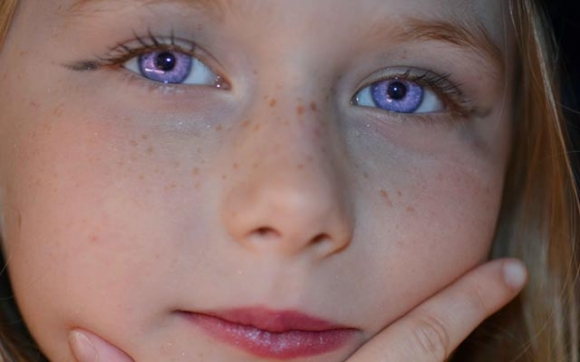 بۆ زانیـــــــاریت -  گۆڕانی رەنگی چاوەكان  Heterochromie :