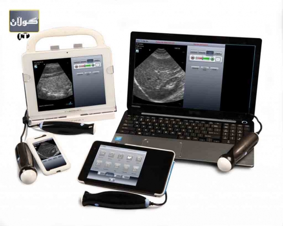 سۆنەركردن لەماڵەوە