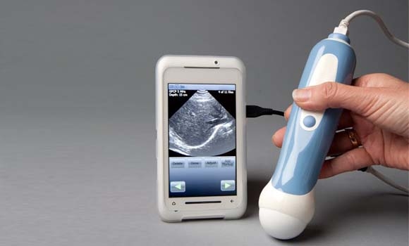 ئامێری سۆنه ر به قه د مۆبایلێك