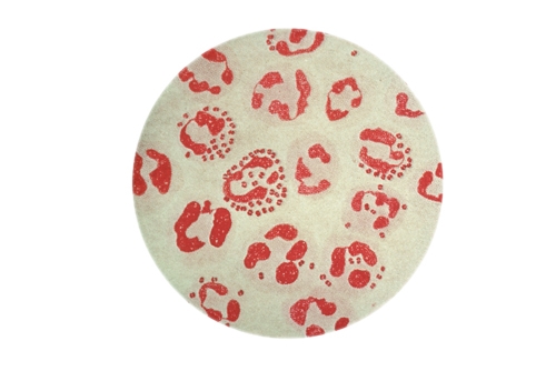 سووزەنەگ هۆكارێكە بۆ نەزۆكی