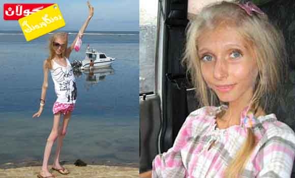 تەمەنی (20) ساڵە و   (20) كیلۆگرامە