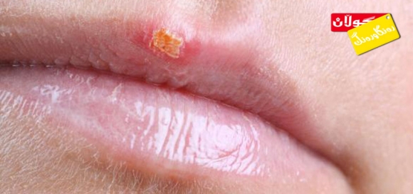 چۆن خۆت لە تامیسكە دەپارێزیت؟