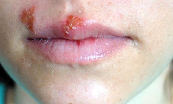 پەستی و تامیسكە