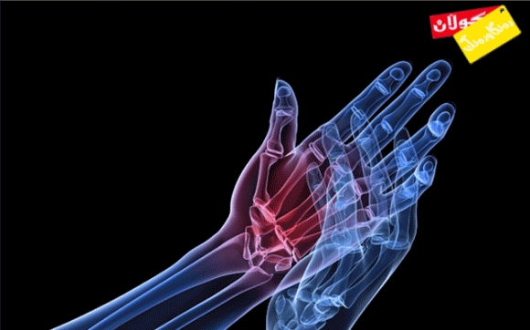 سوود و زیانەكانی دەرزی جومگە