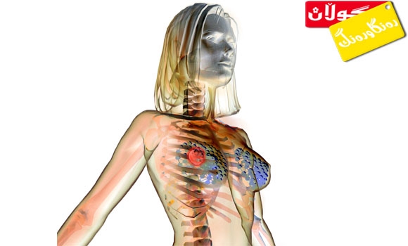 هۆكارەكانی تووشبوون بە شێرپەنجەی مەمك