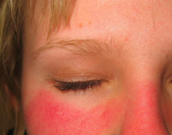 خۆربردن مەترسیدارە