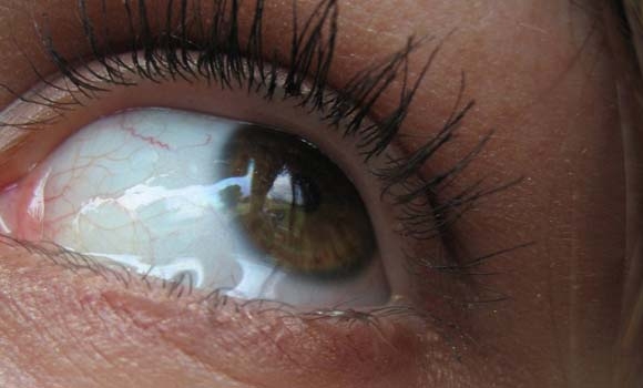 زیاد فرمێسككردن