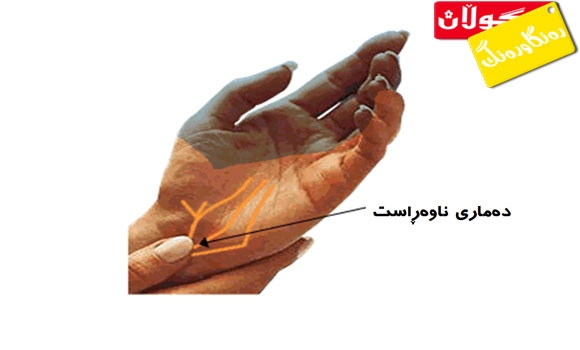 هەوكردنی دەمارەكانی دەوروبەر