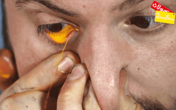 وێنەكێشان بە فرمێسك رێژەی چاو!